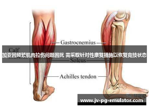 加亚因频繁肌肉拉伤问题困扰 需采取针对性康复措施以恢复竞技状态